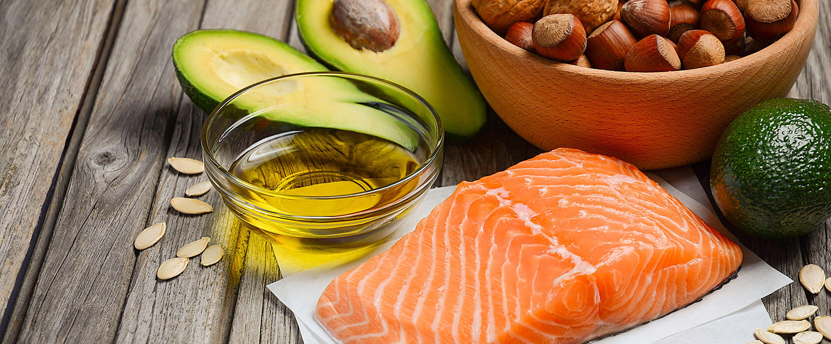 Hoe cholesterol verlagen op natuurlijke wijze? A.Vogel Advies Bloedsomloop